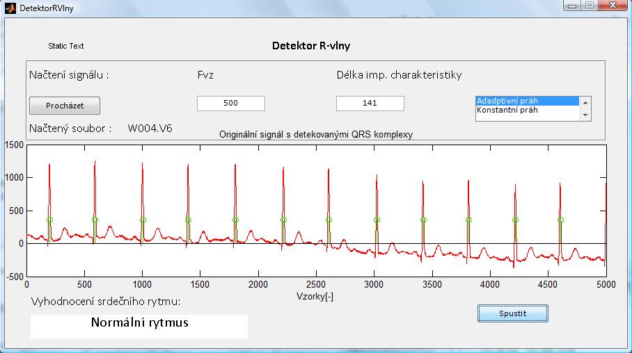 7.1 Rozhraní programu Samotný detektor R-vlny je realizován v grafickém prostředí programu matlab (GUIDE) a to z důvodu přehlednosti a jednoduchosti ovládání pro uživatele.