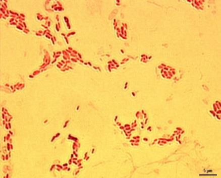 b) Do skupiny vinných bakterií patří Acetobacter orleanensis, Acetobacetr vini acetati, Acetobacter xylinoides, Acetobacter xylinum, Acetobacter ascendens a Acetobacter vini.