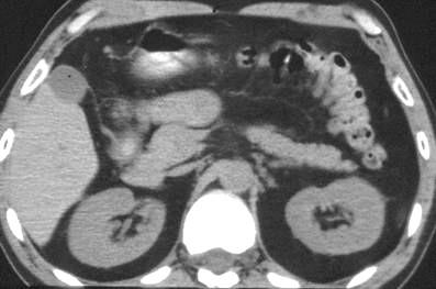 7. Mesocolon transversum = tvoří závěs příčného tračníku.