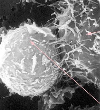 Cytotoxické testy vyšetření schopnosti T lymfocytů a NK buněk zabíjet nádorové buňky CTL