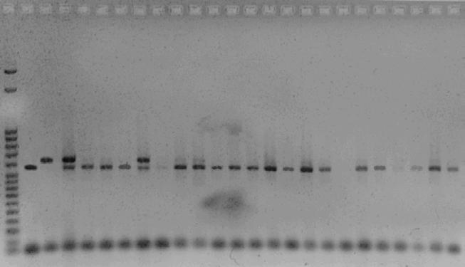 Laboratoř molekulární genetiky rostlin Arabidopsis thaliana Identifikace genů determinujících: - embryogenezi (Genetická kontrola embryogeneze) - délku vegetativní fáze (Genetická kontrola indukce