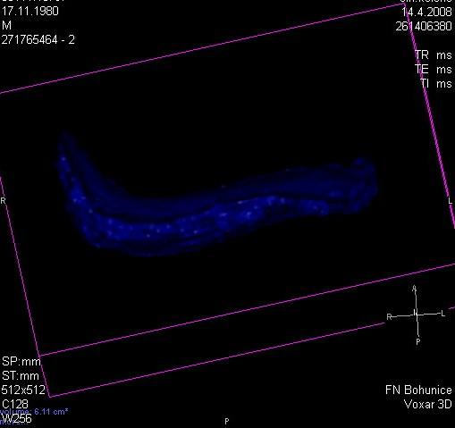 Obr. 24: 3D