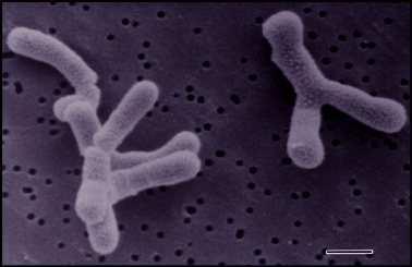 Obrázek 3: Bifidobacterium animalis morfologie buněk [13] Tabulka 3: Distribuce různých druhů bakterií rodu Bifidobacterium [29 upraveno] rod Bifidobacterium B. breve B. bifidum B.