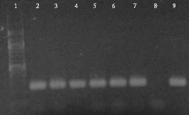 6.3 PCR s DNA izolovanou z potravinového doplňku Linex Forte pomocí magnetického nosiče DNA byla izolována z doplňku Linex Forte podle návodu 2.1.