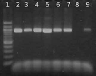 Produkty PCR specifické pro druh Lactobacillus acidophilus o velikosti 800 bp byly detegovány v přibližně stejné intenzitě dle množství DNA v PCR směsi.