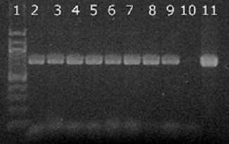 Obrázek 22: Agarózová gelová elektroforéza specifických produktů PCR (800 bp) pro druh Lactobacillus acidophilus.