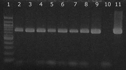 Obrázek 23: Agarózová gelová elektroforéza specifických produktů PCR (800 bp) pro druh Lactobacillus acidophilus.