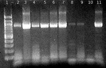 Obrázek 25: Agarózová gelová elektroforéza specifických produktů PCR (914 bp) pro rod Bifidobacterium.