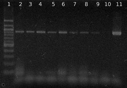 Obrázek 26: Agarózová gelová elektroforéza specifických produktů PCR (914 bp) pro rod Bifidobacterium.