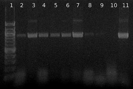 Obrázek 28: Agarózová gelová elektroforéza specifických produktů PCR (925 bp) pro druh Bifidobacterium animalis.