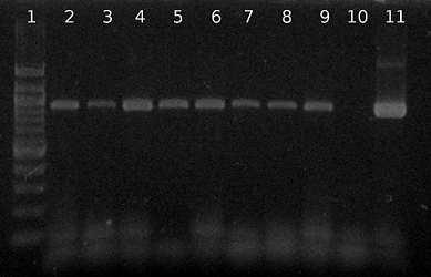 Obrázek 29: Agarózová gelová elektroforéza specifických produktů PCR (925 bp) pro druh Bifidobacterium animalis.