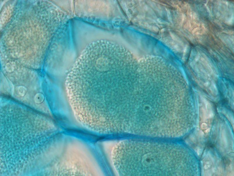 Na snímku cystogenní paraplazmodium v buňkách napadené rostliny (orig.