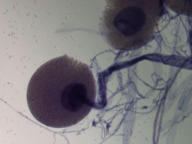 Zygorhynchus Homothalický rod (k pohlavnímu procesu není nutný kontakt dvou fyziologicky odlišných mycelií, označ.