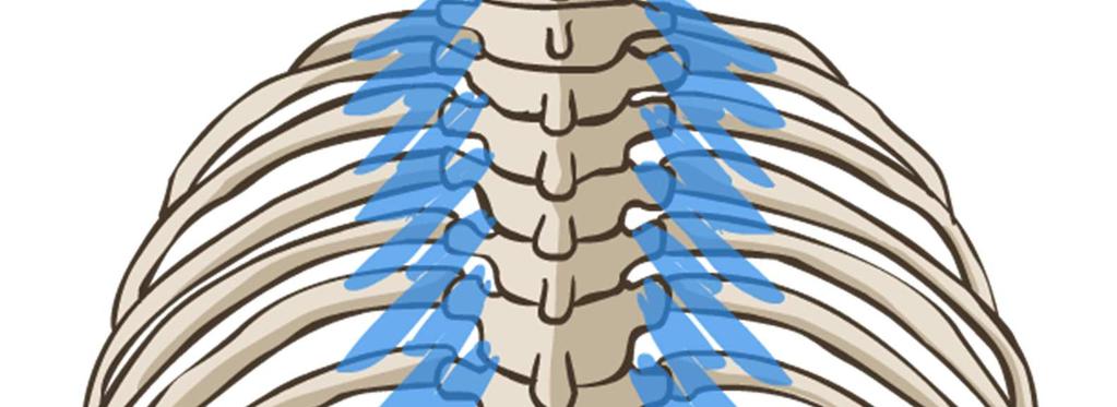 Ligament transvers scapulae ruptum.