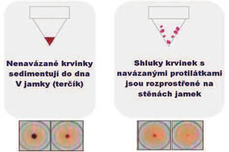 SCREENING SYFILIS U DÁRCŮ assay), respektive elektrochemiluminiscence (ECLIA: electro-chemiluminescence immunoassay) [8, 9].