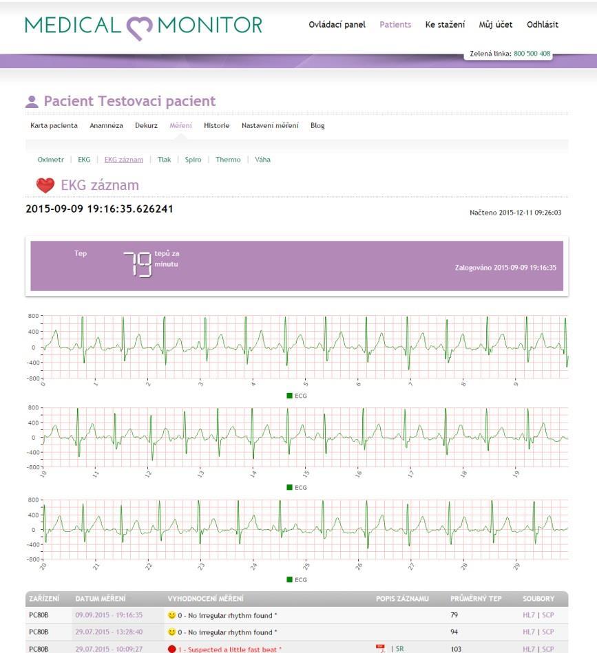 naměřené hodnoty, vývoj stavu pacienta, sledovat disciplínu léčby, reagovat na naměřené hodnoty, stahovat výsledky měření do svého PC, generovat protokoly