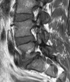 tumor většinou sycení v celém