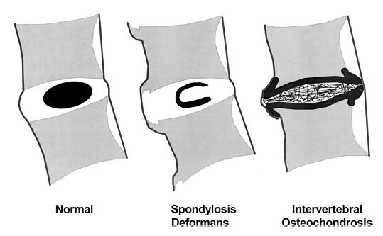 Morfologické abnormality v rámci degenerativního