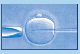 Obrázek: ICSI - přenesení spermie do vajíčka Intracytoplasmatická injekce spermií (ICSI) Při