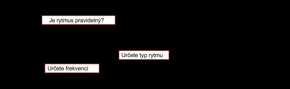 arytmii. Zda je rytmus pravidelný určíme z R-R intervalu, pokud jsou stejně dlouhé, je rytmus pravidelný, pokud ne jedná se o arytmii. Z R-R intervalu odečteme také srdeční frekvenci.