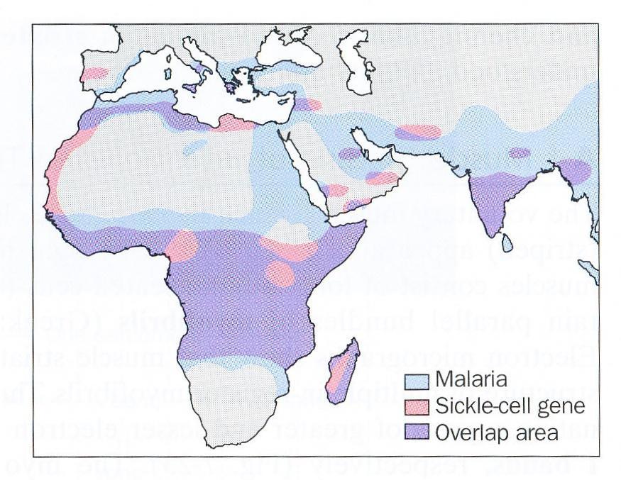 tropech (koincidence s malárií): heterozygotní forma hemoglobinu S