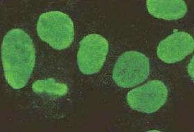 buňky nukleolární typ fluorescence (autoprotilátky proti