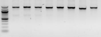 5.3 Purifikace PCR produktů Na gel bylo naneseno 5 µl, z celkových eluovaných 40 µl purifikovaného PCR produktu vyřezaného z gelu.