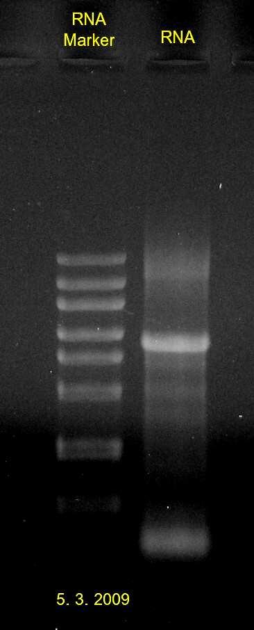 definované pruhy rrna mění v tzv. smír, což je směs různě dlouhých molekul nukleových kyselin, resp. RNA. To je patrné na fotografii gelu č. 2., 3 a 4.