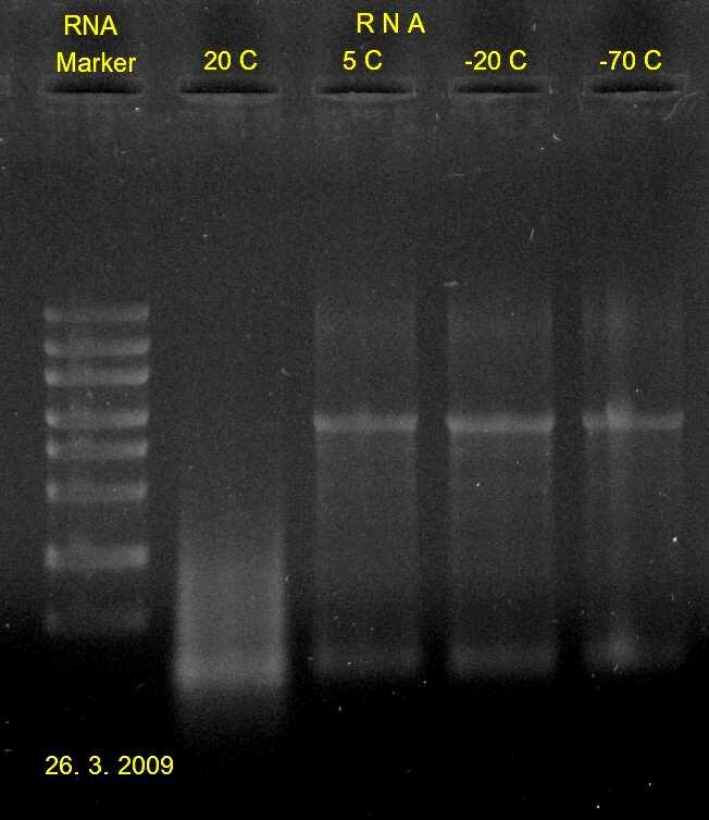 2009, zobrazení markeru (RNA Ladder, High Range), vyizolovaná RNA.; Obrázek 2) 12. 3.