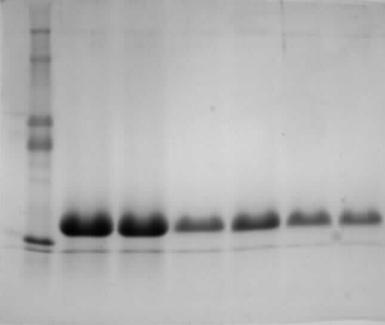 Tab. 8: Naměřené absorbance frakcí z gelové chromatografie pro stanovení pomocí BCA a vypočtené koncentrace proteinů.