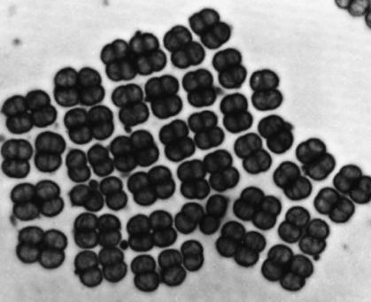 Extrémní radiace Velký rekordman Deinococcus radiodurans (půdní bakterie, všeobecně rozšířená) je zřejmě největším extremofilem vůbec Snáší vysoké dávky ozáření 20 kgy gama záření UV ozáření více než