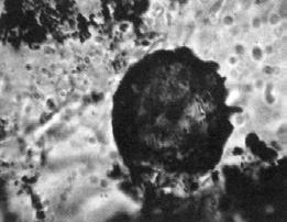 Vlevo erchae Dunaliella, uprostřed Synechococcus (z pacifické solné zóny), vpravo