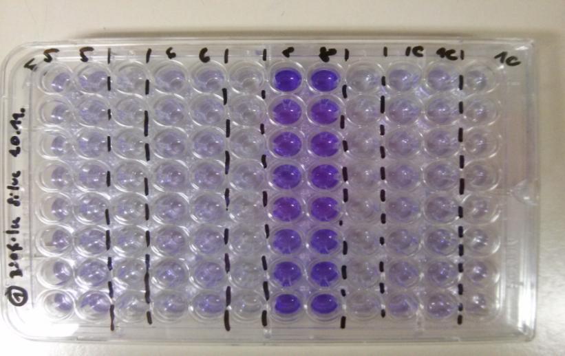 Stanovení schopnosti tvořit biofilm Ke stanovení a kvantifikaci biofilmu byla použita barvící metoda za použití krystalové violeti v mikrotitračních destičkách podle Kurinčič et al. [102].