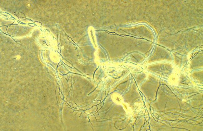 Neocallimastix frontalis Je důležitým komponentem mikroflory bachoru (žaludku),