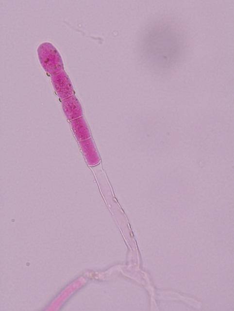 častější je tvorba spor: Sporangiospory (vznik endogenně na sporangiích) Konidie