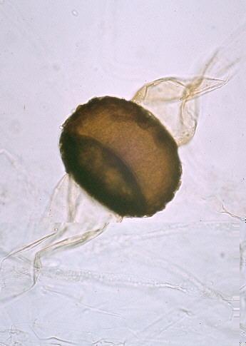 ŘÁD: MUCORALES Cenocytické mycelium, přepážky pod reprodukčními orgány, tvorba stolonů, tvoří