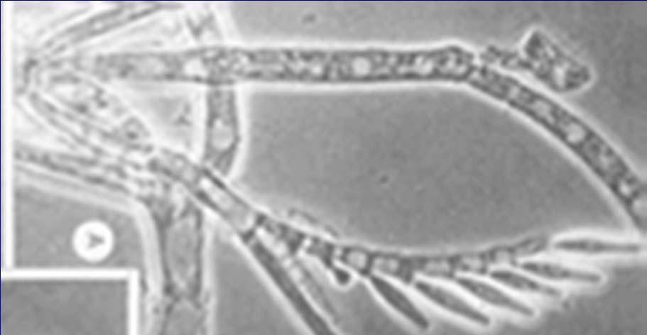 Tř.: TRICHOMYCETES Polyfyletická skupina nejasného taxonomického zařazení Mycelium je redukované, větvené nebo nevětvené, někdy přehrádkované Nepohlavní rozmnožování: sporangiospory, arthrospory,
