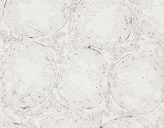Dobarveno hematoxylinem, originální zvětšení 200 Malý počet TUNEL pozitivních buněk v zárodečném epitelu jsme nalezli ve