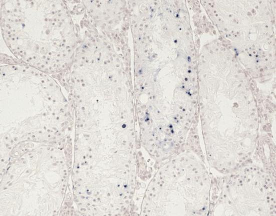 kanálcích. TUNEL pozitivní spermatogonie jsou demonstrovány v semenotvorném kanálku na Obr. 38A.