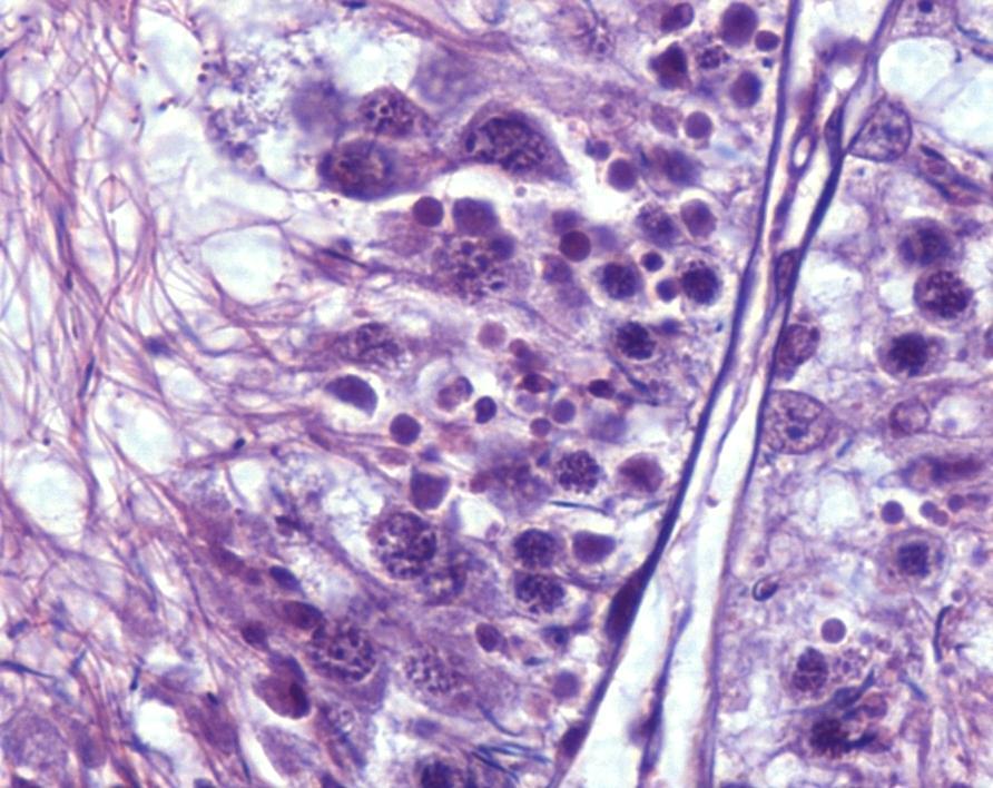 kulatobuněčné formy zárodečných buněk.