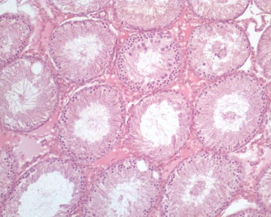 VÝSLEDKY HISTOLOGICKÉHO HODNOCENÍ KONTROLNÍ SKUPINA Zvířata, kterým bylo dvakrát aplikováno vehikulum DMSO (dimethylsulfoxid), měla neporušený zárodečný epitel se Sertoliho buňkami a všemi stádii