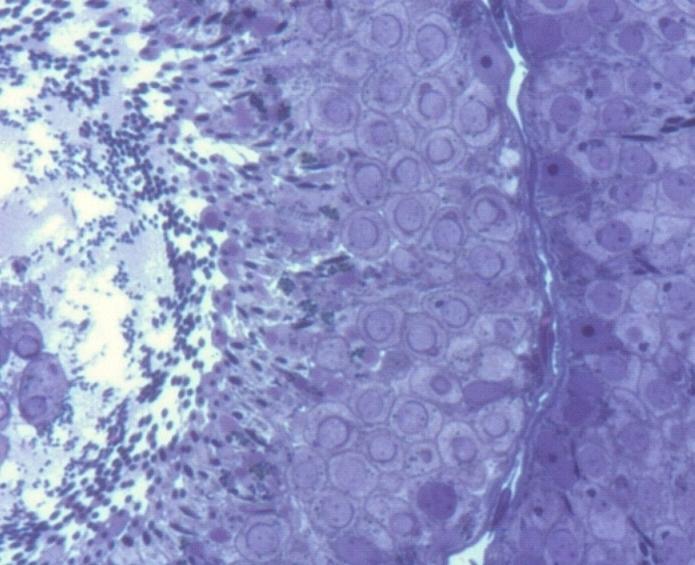 zárodečných buněk; B (B) 7 dní při bazální membráně chybí spermatogonie a téměř zcela