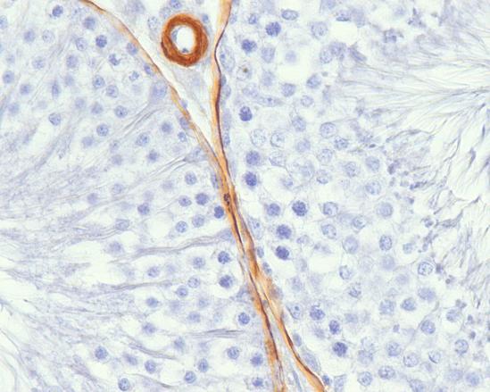 Výsledková část - Cytoskelet CYTOSKELET Exprese aktinu, tubulinu i vimentinu vykazovala v kontrolních varlatech expresi závislou na stádiu zárodečného epitelu.