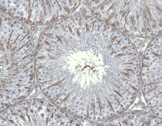 Výsledková část - Cytoskelet TUBULIN Tubulinová vlákna v Sertoliho buňkách kontrolních zvířat byla uspořádána do provazců mezi zárodečnými buňkami od bazální membrány aţ do jejich apikálních výběţků