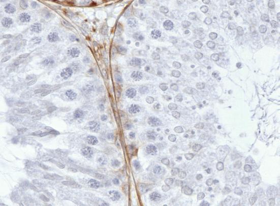 Ve varlatech kontrolní skupiny se vimentinová filamenta v Sertoliho buňkách vyskytovala v bazální a perinukleární oblasti