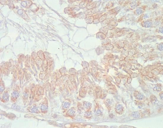 V dalších intervalech (3-11 dní), kdy se z epitelu odlučovaly také spermatocyty, zůstala exprese v cytoplazmě odloučených