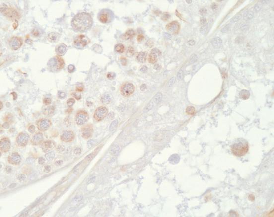 Dobarveno hematoxylinem, originální zvětšení - 200 Poškození zárodečného epitelu busulfanem resultovalo v podobné změny v