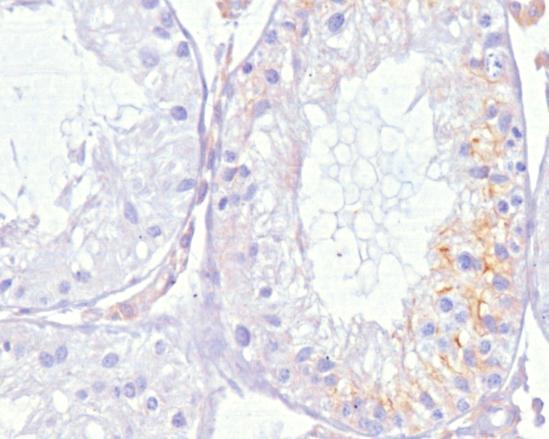 Dobarveno hematoxylinem, originální zvětšení (A, B) - 200, (C, D) - 400 Ačkoliv došlo jiţ po 2 dnech trvání kryptorchismu k odlučování prvních buněk ze