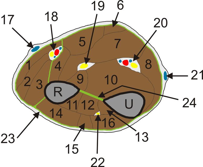 SECTIO ANTEBRACHII (není povinné) R+U Radius + Ulna 1. m. brachioradialis 2. m. extensor carpi radialis longus 3. m. extensor carpi radialis brevis 4. m. pronator teres 5. m. flexor carpi radialis 6.