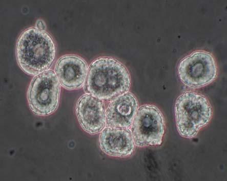 Složení kompletního Williamsova E média: Do Williamsova E média bez L-glutaminu a fenolčerveně (Biotech) je přidáno fetální bovinní sérum (10%, Biotech), L-glutamin (2 mm, Biotech), penicilin (200
